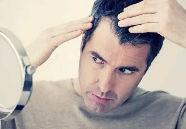 تعبیر خواب سیاه شدن موی سفید برای زن متاهل و باردار و دختر مجرد از روانشناسی