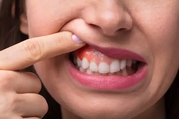 تعبیر خواب آشغال لای دندان برای زن متاهل و باردار و دختر مجرد از روانشناسی