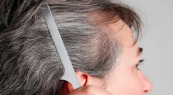 تعبیر خواب مو سفید دیگران برای زن متاهل و باردار و دختر مجرد از روانشناسی